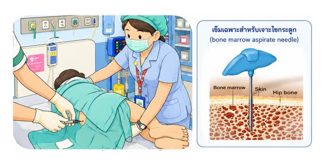 bone marrow aspiration